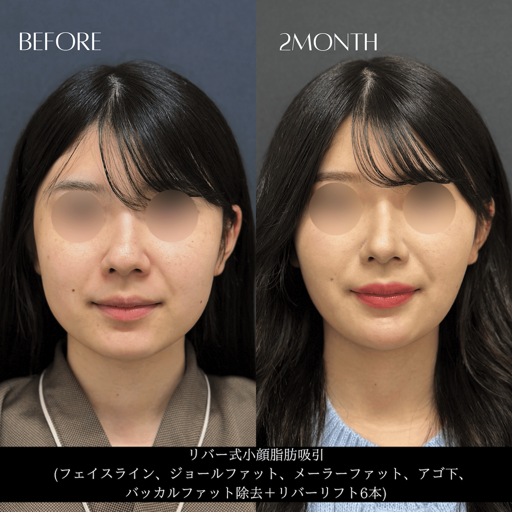 症例