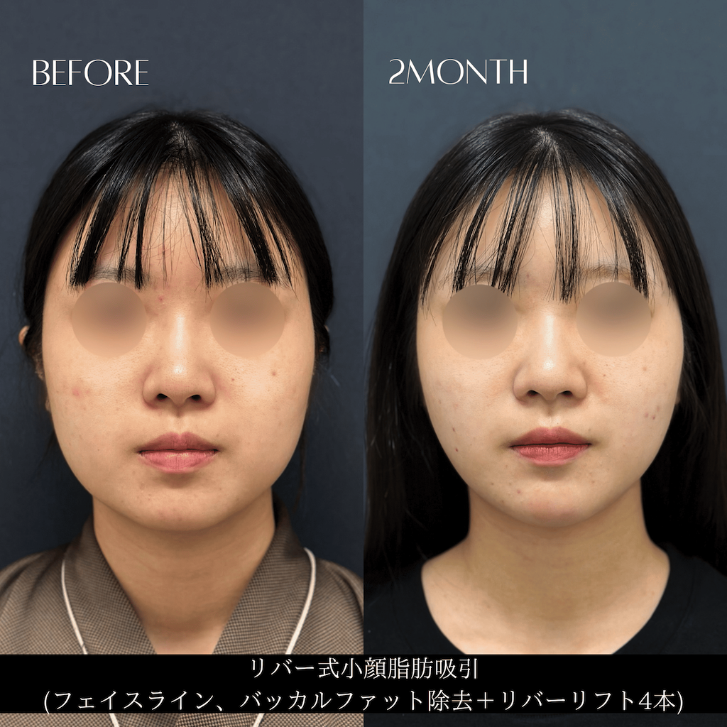症例